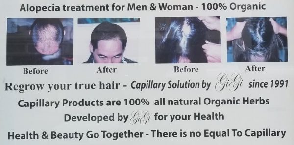 Capillary Hair Lotion For Hair Loss Treatment by Gigi, Alopecia Treatment for Men and women