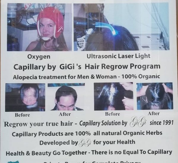Oxygen Hair Treatment by Gigi. Helps grow your hair and prevents hair loss